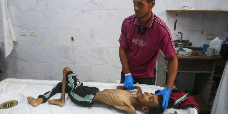 Starvation as a weapon, silence as complicity