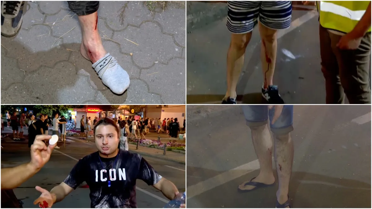 N1 crew member injured at protest in Vrbas